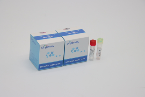 Количественный дневной набор IVD обнаружения PCR для всех перегласовок вируса короны