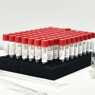 Трубка набора 0.5mL/извлечения реагента отпуска образца пробирки фаринкса носовая без препроцессирования